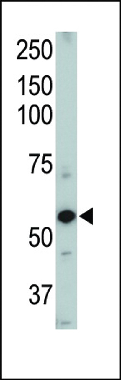 Western blot of ACVRL1 Pab . TOP LEFT: Mouse heart tissue lysate.