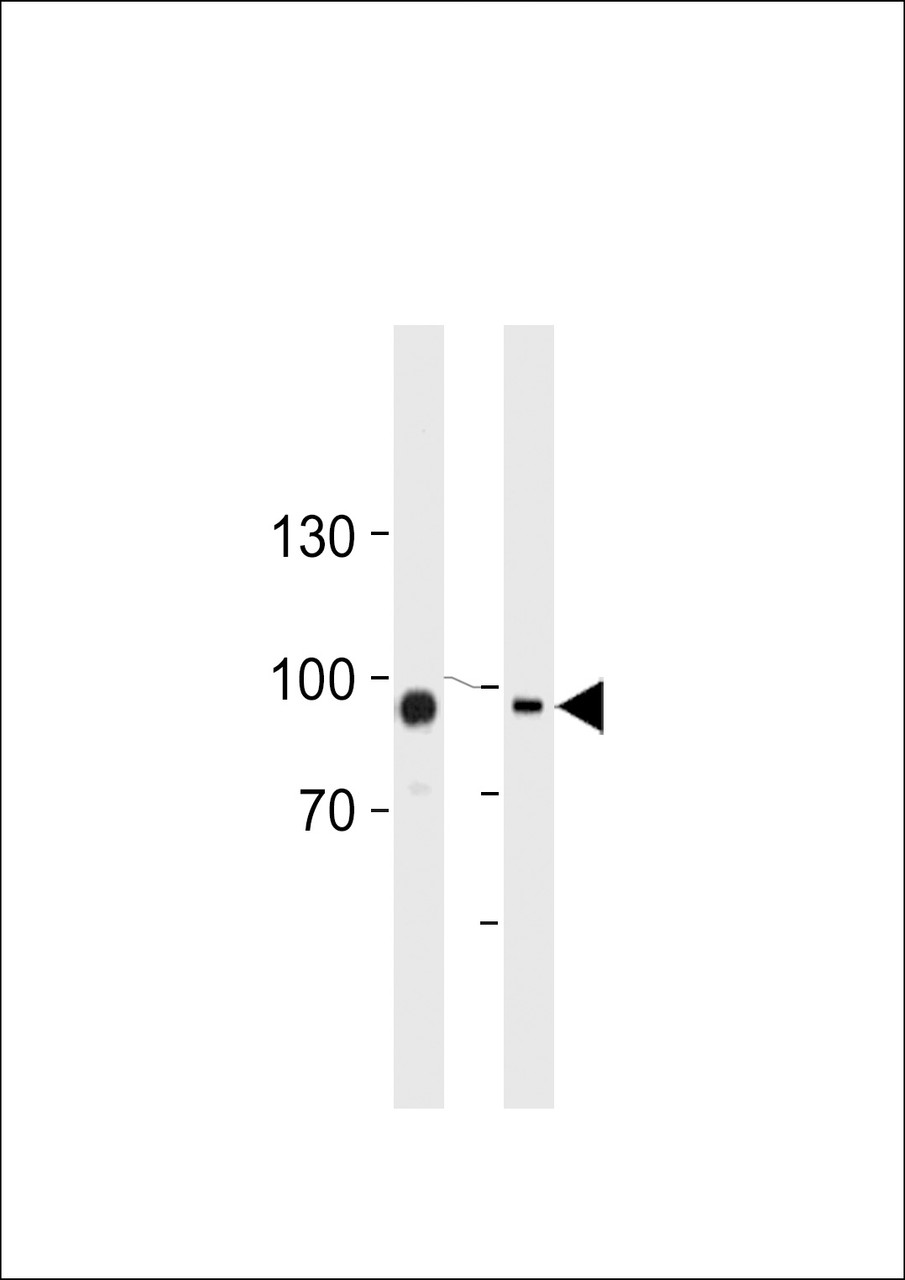 Western blot analysis in HUVEC, K562 cell line lysates (35ug/lane) .This demonstrates the TGM2 antibody detected the TGM2 protein (arrow) .