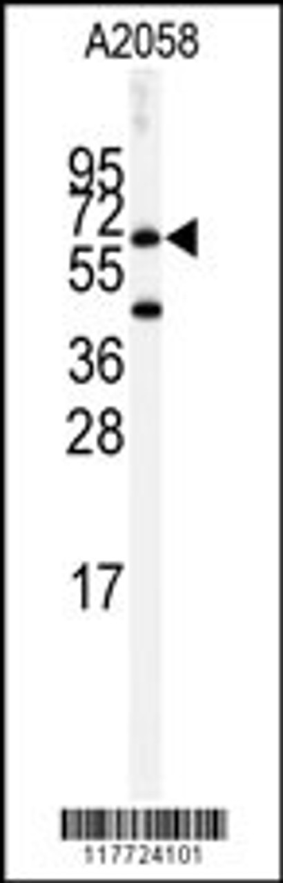 Western blot analysis of anti-BCHE Antibody in A2058 cell line lysates (35ug/lane)