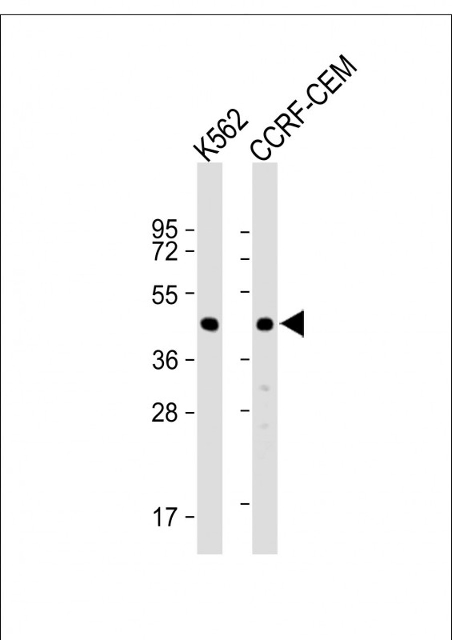 Western Blot at 1:1000 dilution Lane 1: K562 whole cell lysate Lane 2: CCRF-CEM whole cell lysate Lysates/proteins at 20 ug per lane.