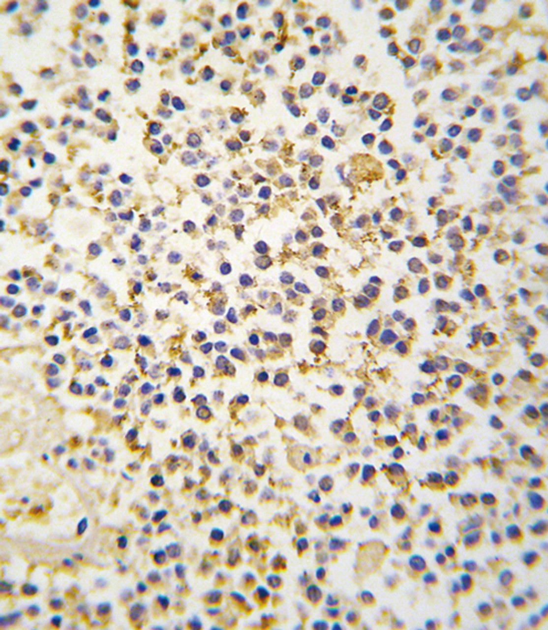 Formalin-fixed and paraffin-embedded human kideny tissue reacted with ALDH1A3 antibody (N-term) , which was peroxidase-conjugated to the secondary antibody, followed by DAB staining.