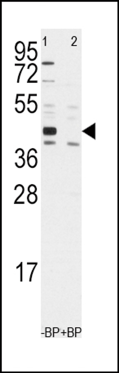 Western blot analysis of anti-ALDH1A3 Antibody pre-incubated with and without blocking peptide in Jurkat cell line lysate