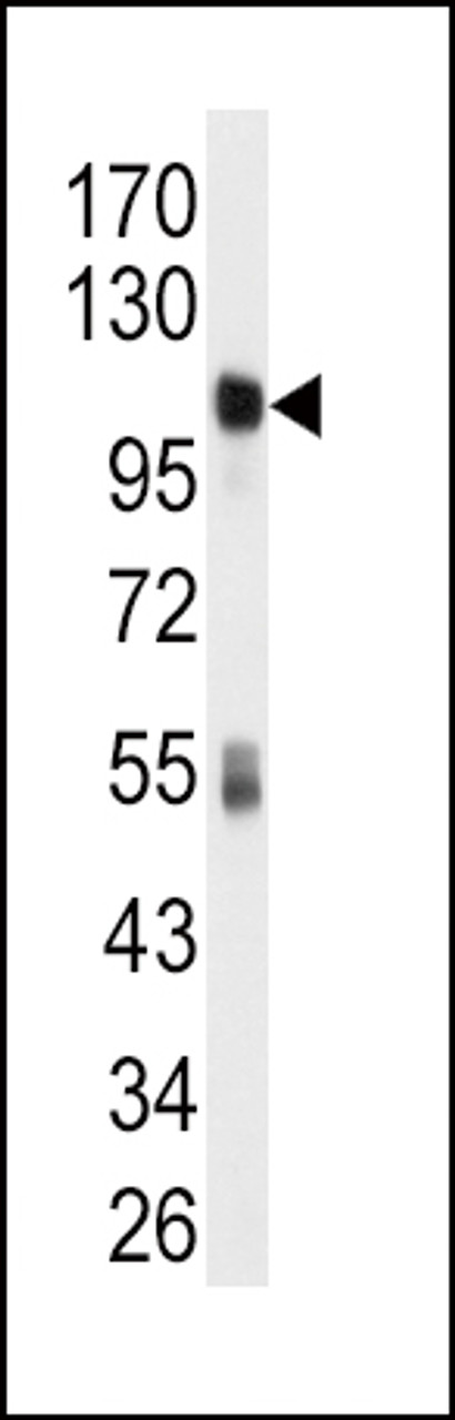 Western blot analysis of anti-ALDH1L1 Antibody in mouse liver tissue lysates (35ug/lane) .