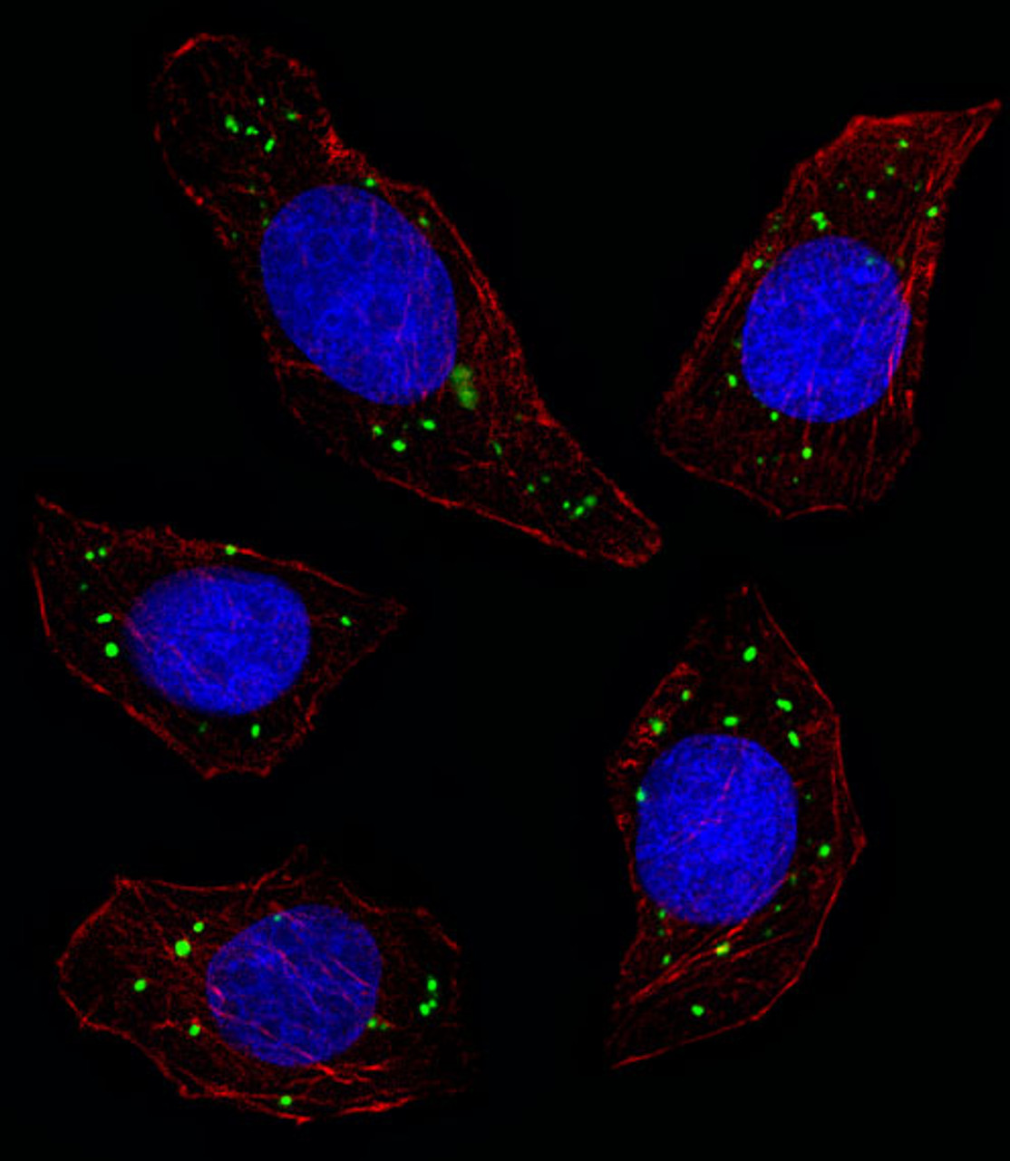 Fluorescent image of U251 cell stained with MERTK Antibody.U251 cells were fixed with 4% PFA (20 min) , permeabilized with Triton X-100 (0.1%, 10 min) , then incubated with MERTK primary antibody (1:25) . For secondary antibody, Alexa Fluor 488 conjugated donkey anti-rabbit antibody (green) was used (1:400) .Cytoplasmic actin was counterstained with Alexa Fluor 555 (red) conjugated Phalloidin (7units/ml) . Nuclei were counterstained with DAPI (blue) (10 ug/ml, 10 min) .MERTK immunoreactivity is localized to Vesicles significantly.
