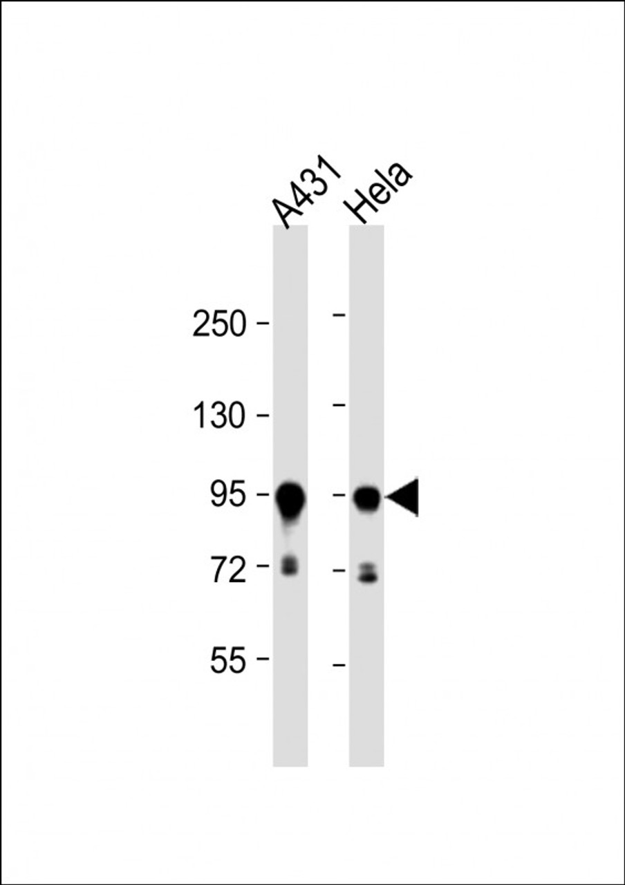 Western Blot at 1:1000 dilution Lane 1: A431 whole cell lysate Lane 2: Hela whole cell lysate Lysates/proteins at 20 ug per lane.