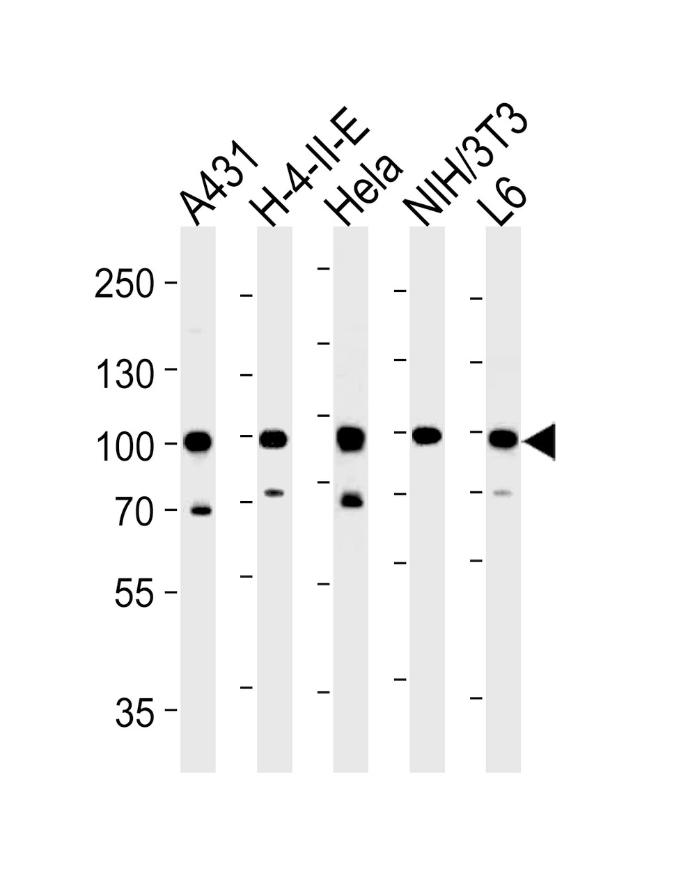 Western blot analysis in A431, H-4-II-E, Hela, mouse NIH/3T3, rat L6 cell line lysates (35ug/lane) .This demonstrates the HSP90AB1 antibody detected the HSP90AB1 protein (arrow) .
