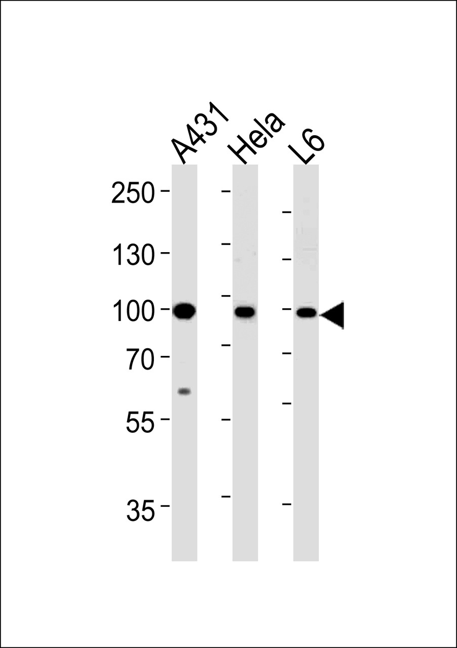 Western blot analysis in A431, Hela, L6 cell line lysates (35ug/lane) .This demonstrates the HSP90AB1 antibody detected the HSP90AB1 protein (arrow) .