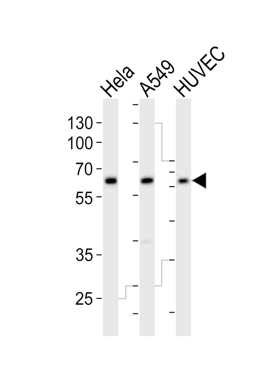 Western blot analysis of lysates from Hela, A549, HUVEC cell line (from left to right) , using ESRRG Antibody at 1:1000 at each lane.