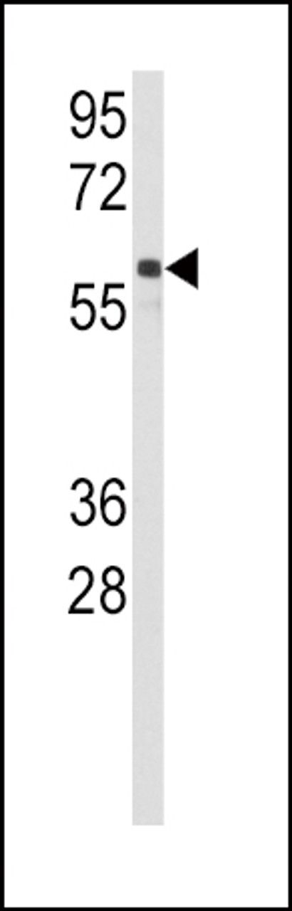 Western blot analysis of anti-CYP2C9 Antibody in Jurkat cell line lysates (35ug/lane) .