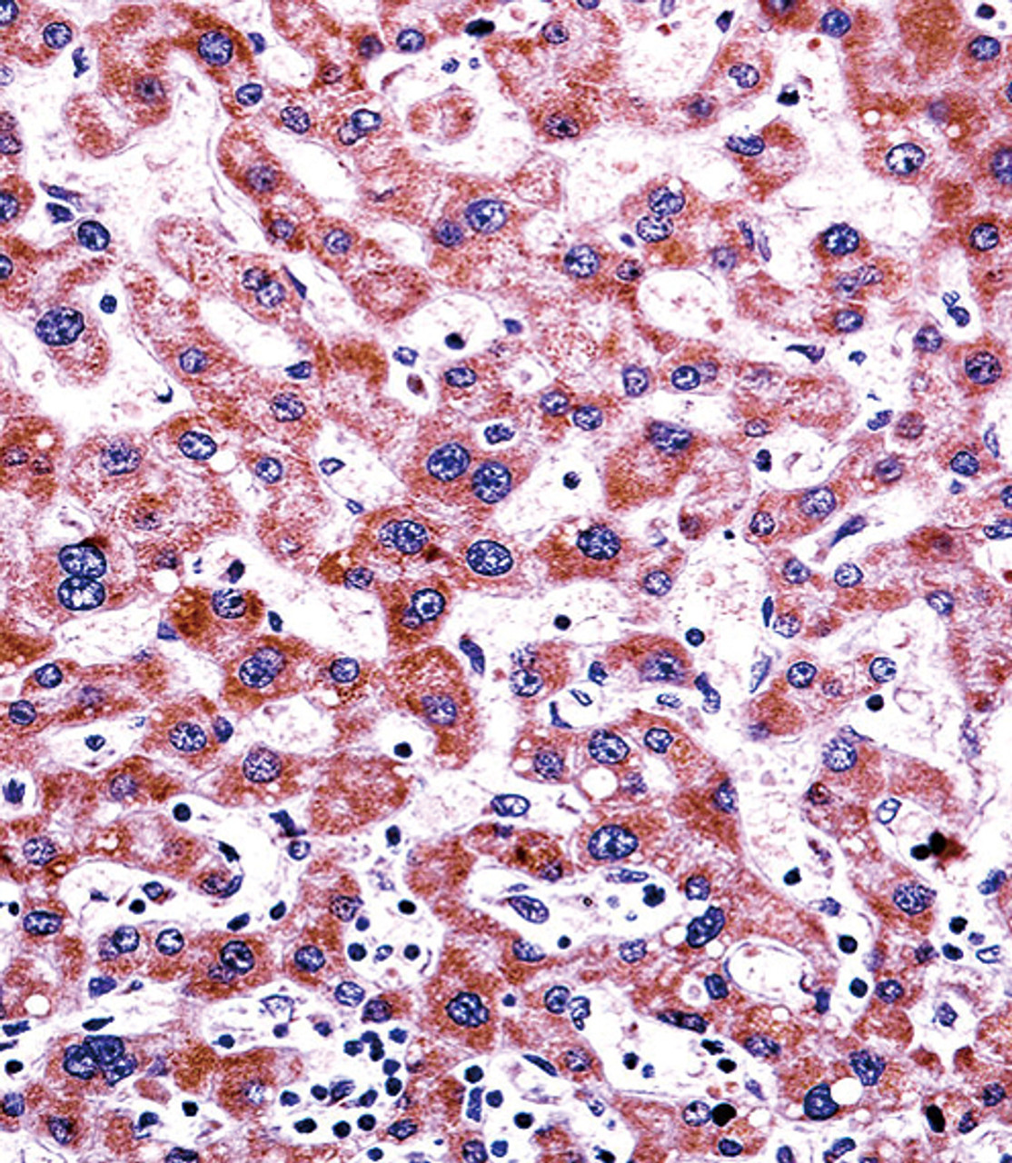 CYP2C9 Antibody immunohistochemistry analysis in formalin fixed and paraffin embedded human liver tissue followed by peroxidase conjugation of the secondary antibody and DAB staining.