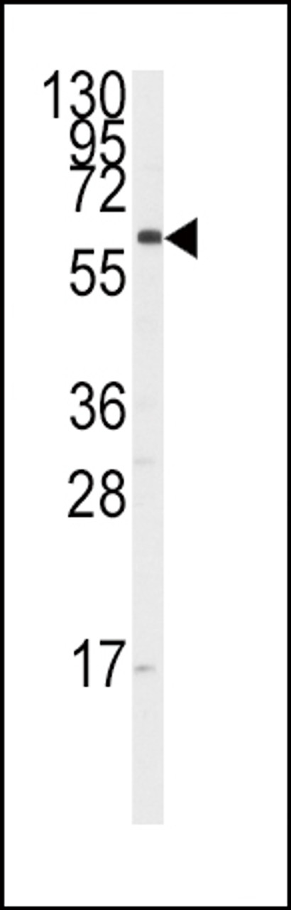 Western blot analysis of anti-CYP17A1 Antibody in K562 cell line lysates (35ug/lane) .