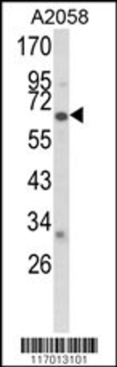 Western blot analysis of CYP2F1 Antibody in A2058 cell line lysates (35ug/lane)