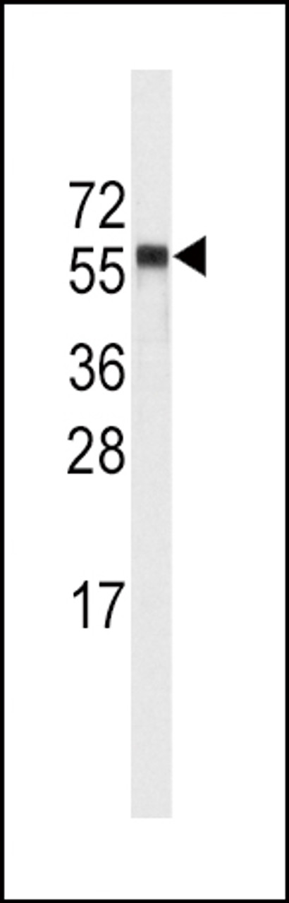 Western blot analysis of anti-CYP4A11 (4A22) Antibody in NCI-H460 cell line lysates (35ug/lane) .