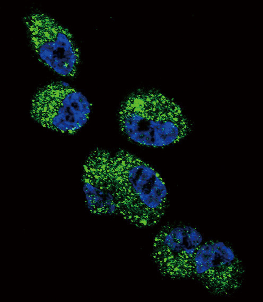 Confocal immunofluorescent analysis of CYP4A11 (4A22) Antibody with NCI-H460 cell followed by Alexa Fluor 488-conjugated goat anti-rabbit lgG (green) .DAPI was used to stain the cell nuclear (blue) .