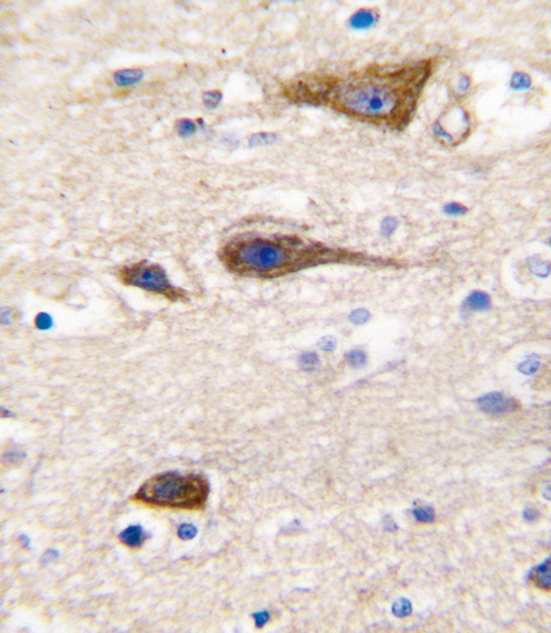Formalin-fixed and paraffin-embedded human brain tissue reacted with CYP2R1 antibody, which was peroxidase-conjugated to the secondary antibody, followed by DAB staining.
