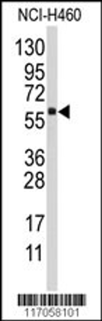 Western blot analysis of anti-CYP4F12 Antibody in NCI-H460 cell line lysates (35ug/lane) .