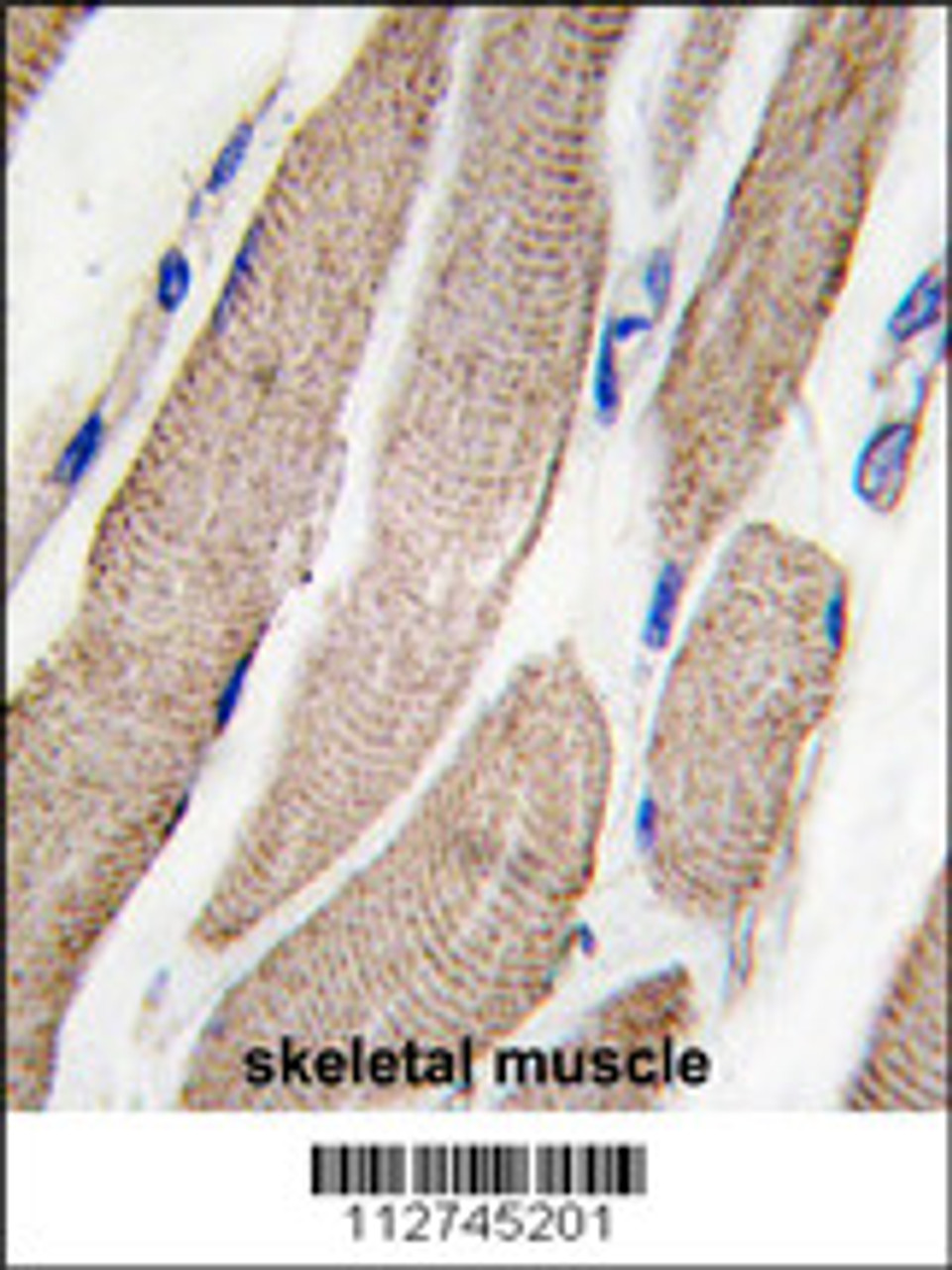 Formalin-fixed and paraffin-embedded human skeletal muscle tissue reacted with MAP2K5 Antibody (S149) , which was peroxidase-conjugated to the secondary antibody, followed by DAB staining.