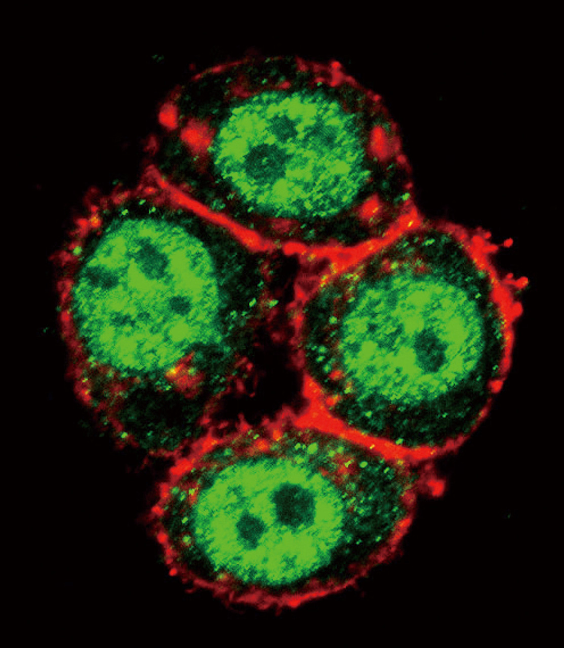 Confocal immunofluorescent analysis of PAK1 Antibody (T423) with Hela cell followed by Alexa Fluor 488-conjugated goat anti-rabbit lgG (green) . Actin filaments have been labeled with Alexa Fluor 555 phalloidin (red) .