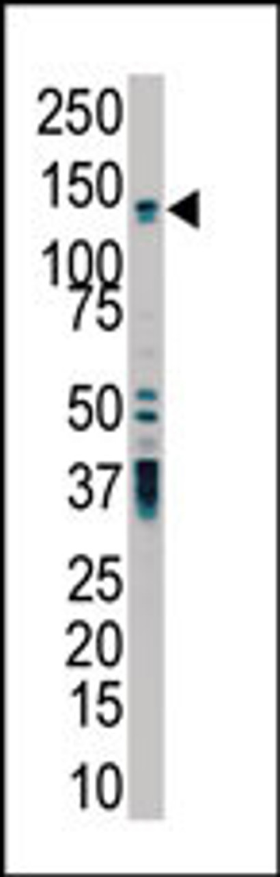 Antibody is used in Western blot to detect PKD2 in HL-60 cell lysate.