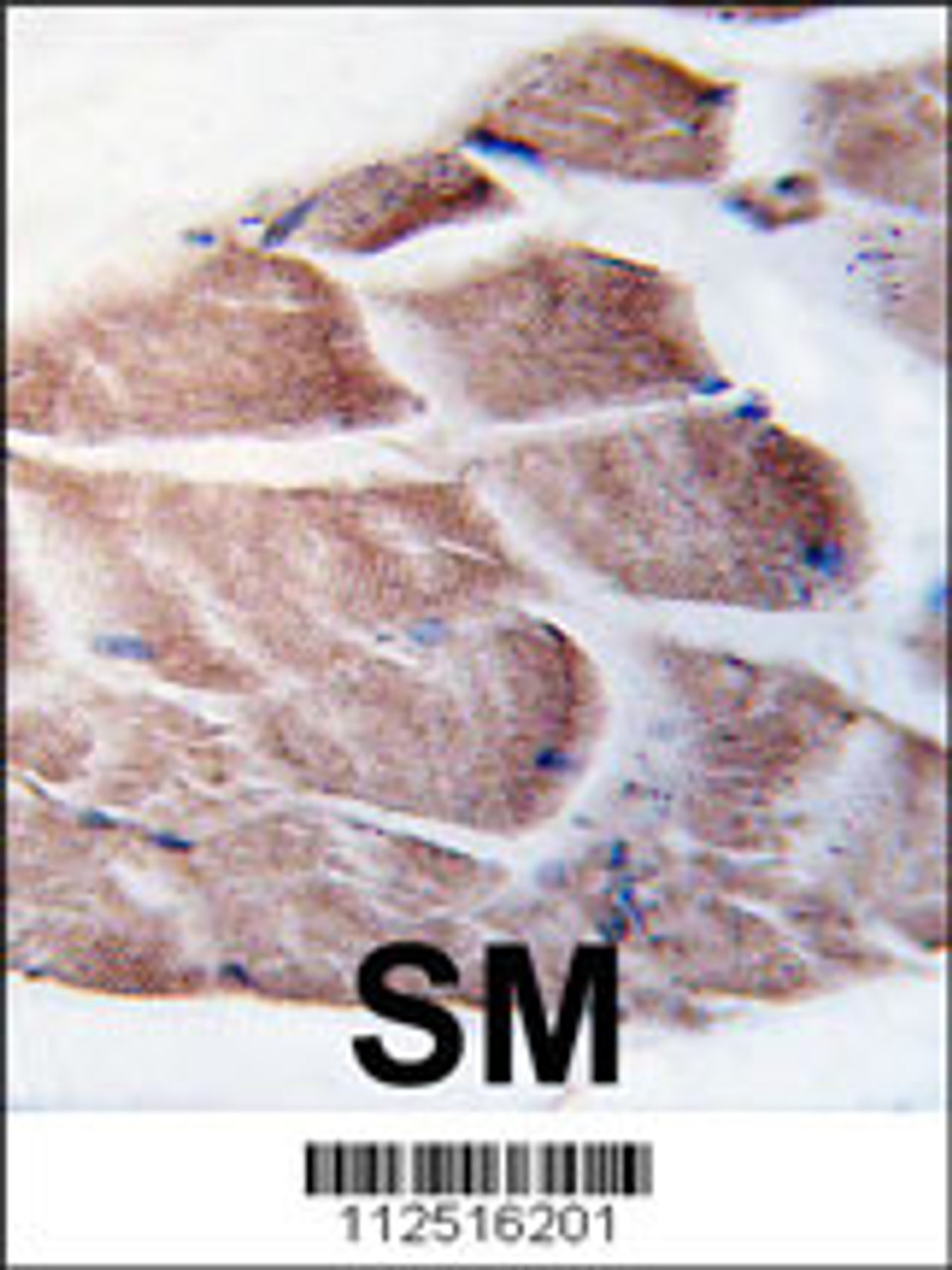Formalin-fixed and paraffin-embedded human skeletal muscle tissue reacted with RSK3 antibody, which was peroxidase-conjugated to the secondary antibody, followed by DAB staining.
