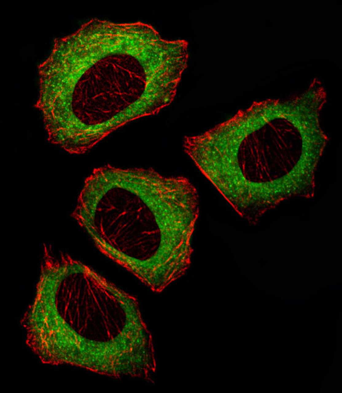 Fluorescent image of U251 cell stained with MEK2 (MAP2K2) Antibody . U251 cells were fixed with 4% PFA (20 min) , permeabilized with Triton X-100 (0.1%, 10 min) , then incubated with MEK2 primary antibody (1:25) . For secondary antibody, Alexa Fluor 488 conjugated donkey anti-rabbit antibody (green) was used (1:400) .Cytoplasmic actin was counterstained with Alexa Fluor 555 (red) conjugated Phalloidin (7units/ml) . MEK2 immunoreactivity is localized to Cytoplasm significantly.