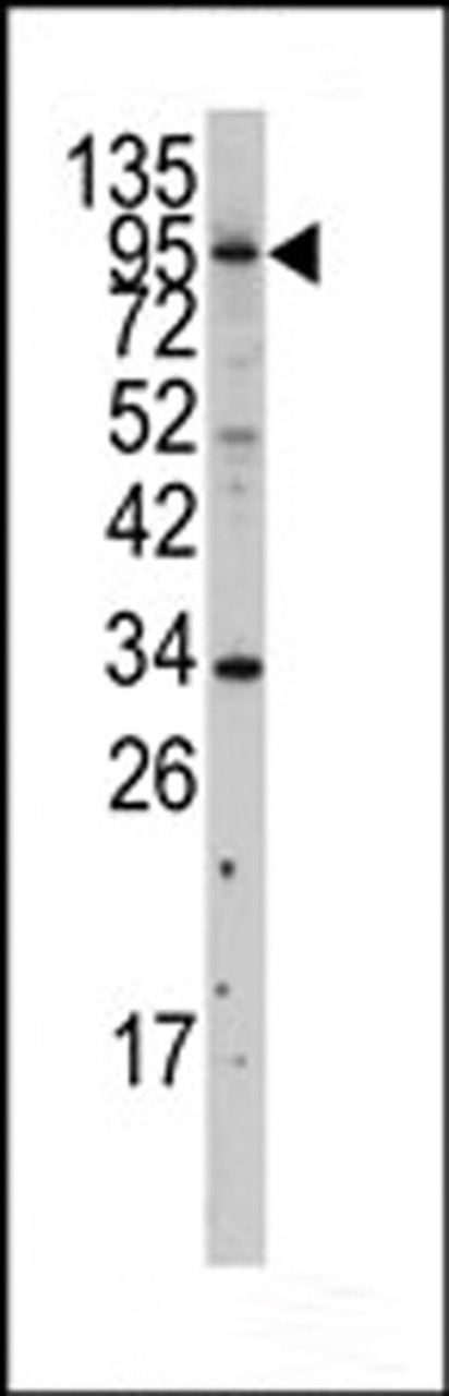 Western blot analysis of anti-MYLK3 Antibody in A375 cell line lysates (35ug/lane)