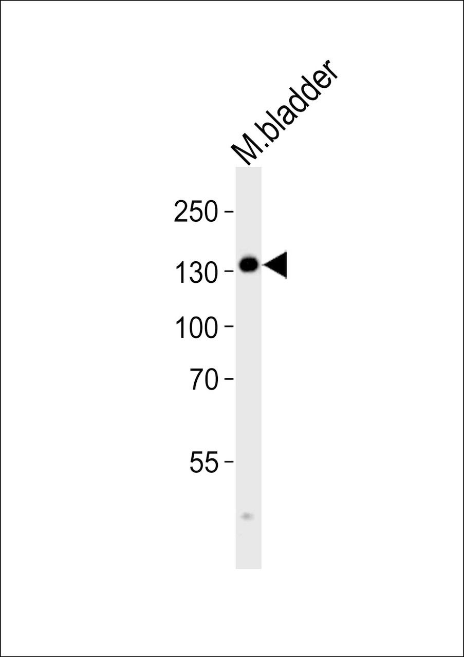 Western blot analysis of lysate from mouse bladder tissue lysate, using MLCKlong Antibody (M1) at 1:1000.