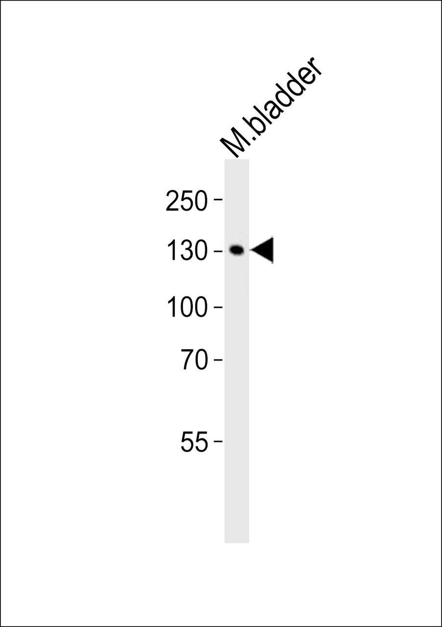 Western blot analysis of lysate from mouse bladder tissue lysate, using MLCKlong Antibody (M1) at 1:1000.