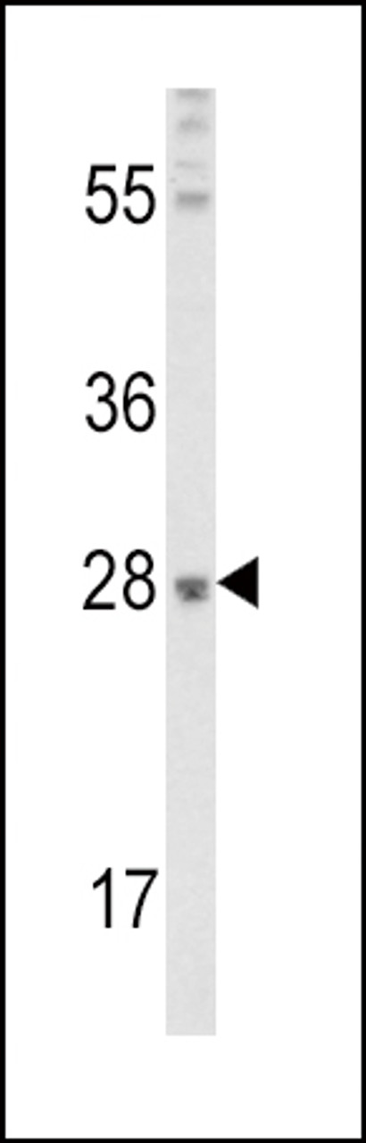 Western blot analysis of FGF10 Antibody in mouse lung tissue lysates (35ug/lane)