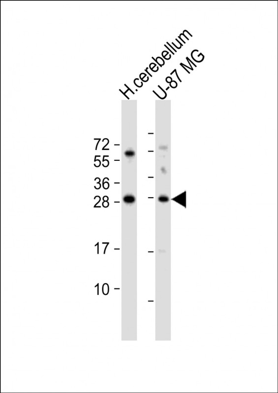 Western Blot at 1:1000 dilution Lane 1: human cerebellum lysate Lane 2: U-87 MG whole cell lysate Lysates/proteins at 20 ug per lane.