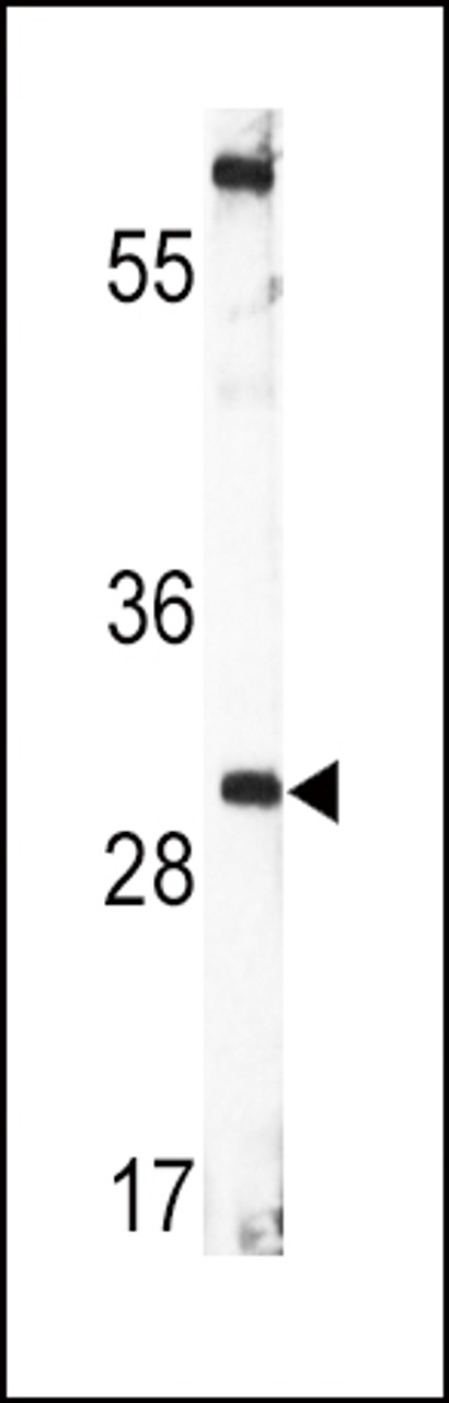 Western blot analysis of BDNF Antibody in CEM cell line lysates (35ug/lane)