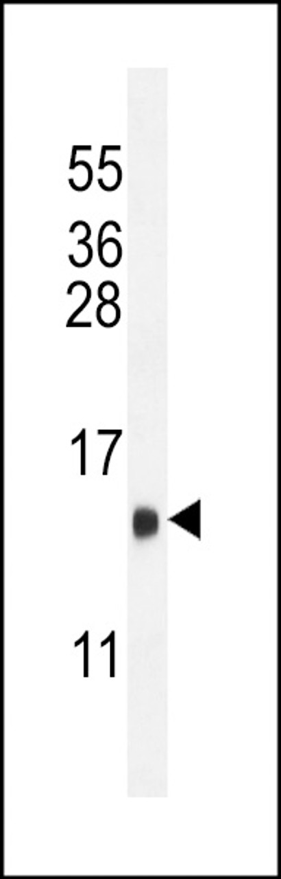 Western blot analysis in mouse heart tissue lysates (35ug/lane) .