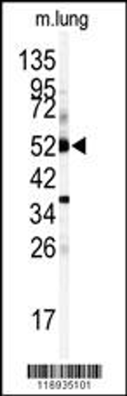 Western blot analysis of anti-CYP1A1 Antibody in mouse lung tissue lysates (35ug/lane)
