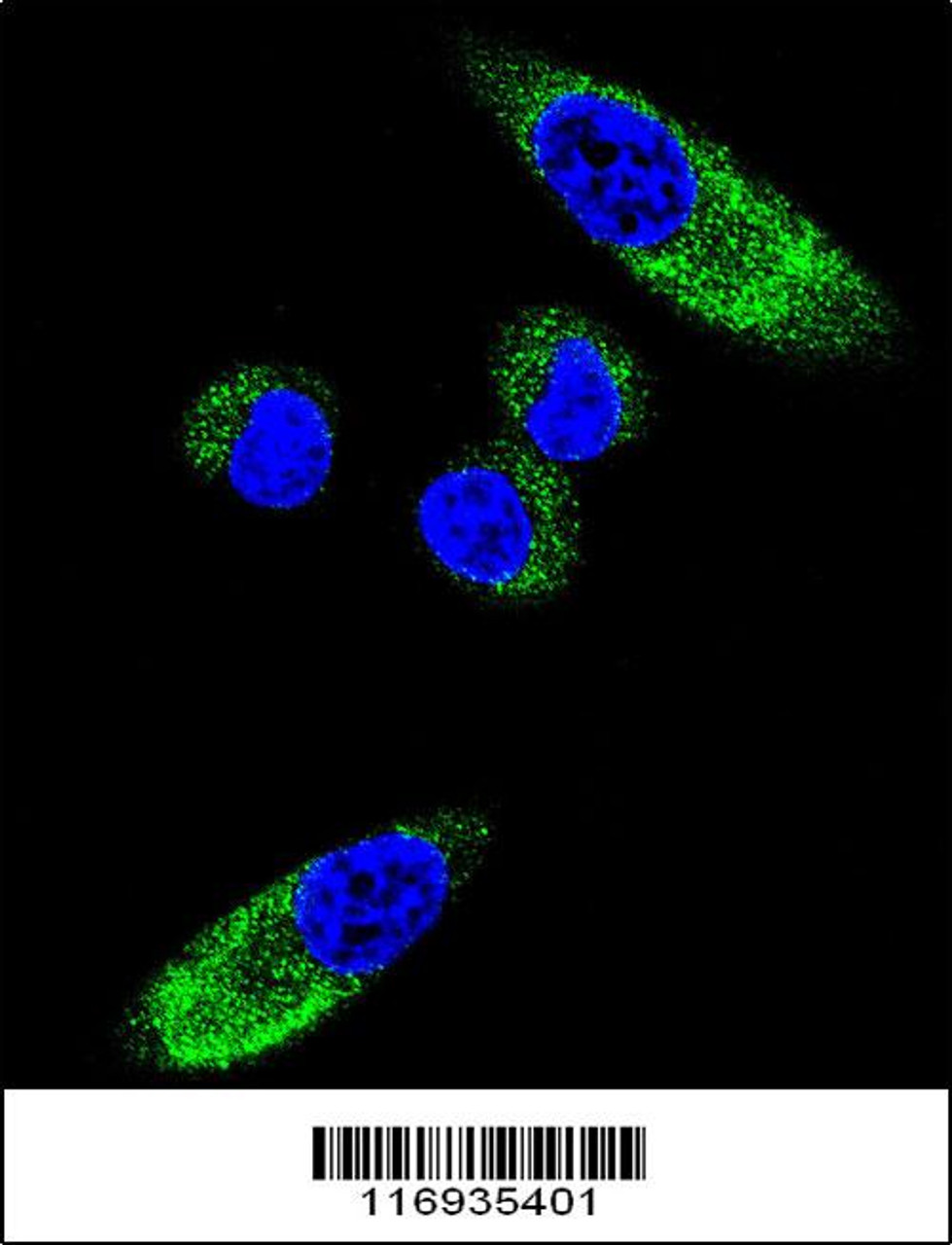 Confocal immunofluorescent analysis of CYP1A1 Antibody with MDA-MB231 cell followed by Alexa Fluor 488-conjugated goat anti-rabbit lgG (green) .DAPI was used to stain the cell nuclear (blue) .