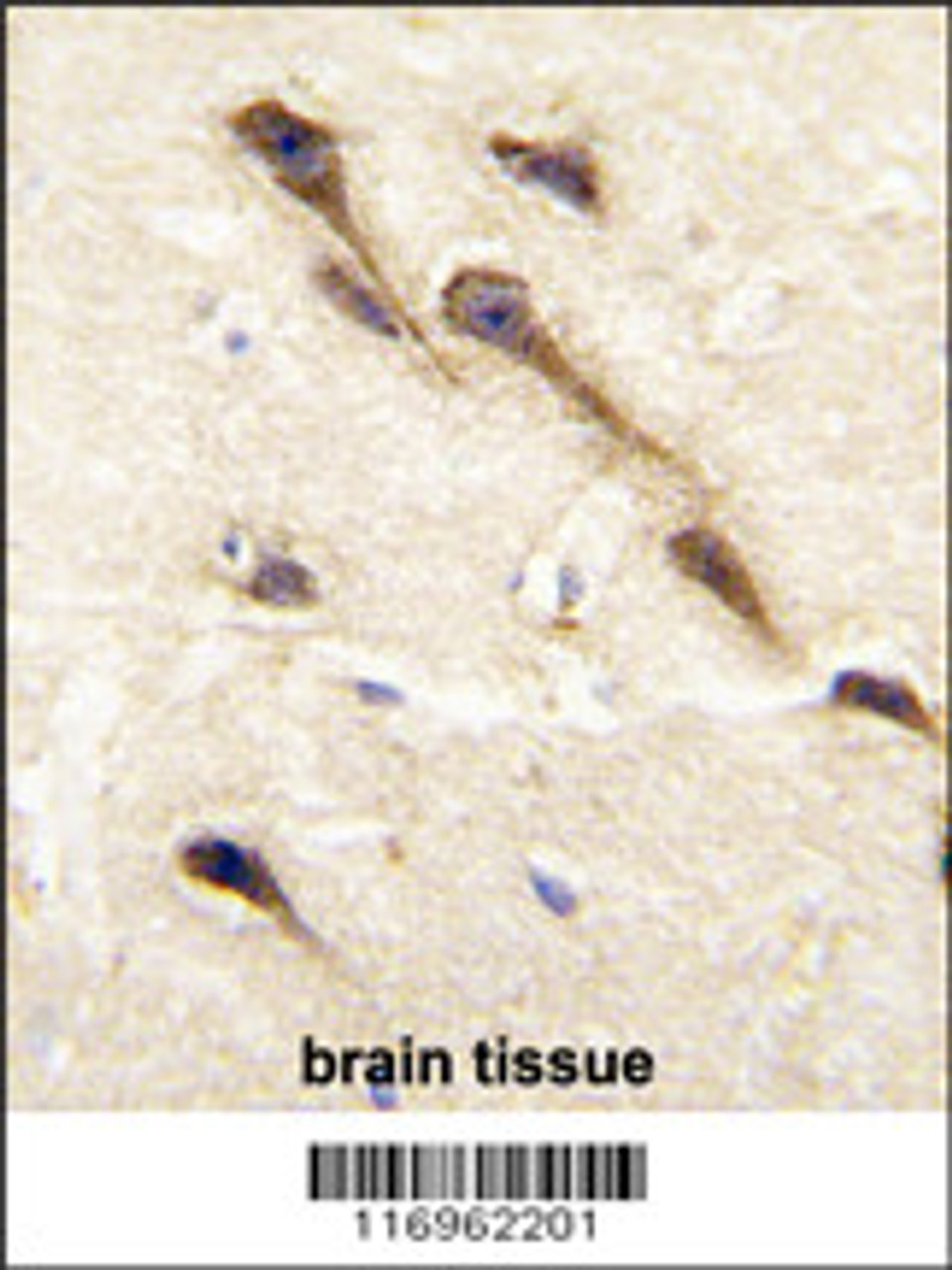 Formalin-fixed and paraffin-embedded human brain tissue reacted with CYP26B1 antibody, which was peroxidase-conjugated to the secondary antibody, followed by DAB staining.