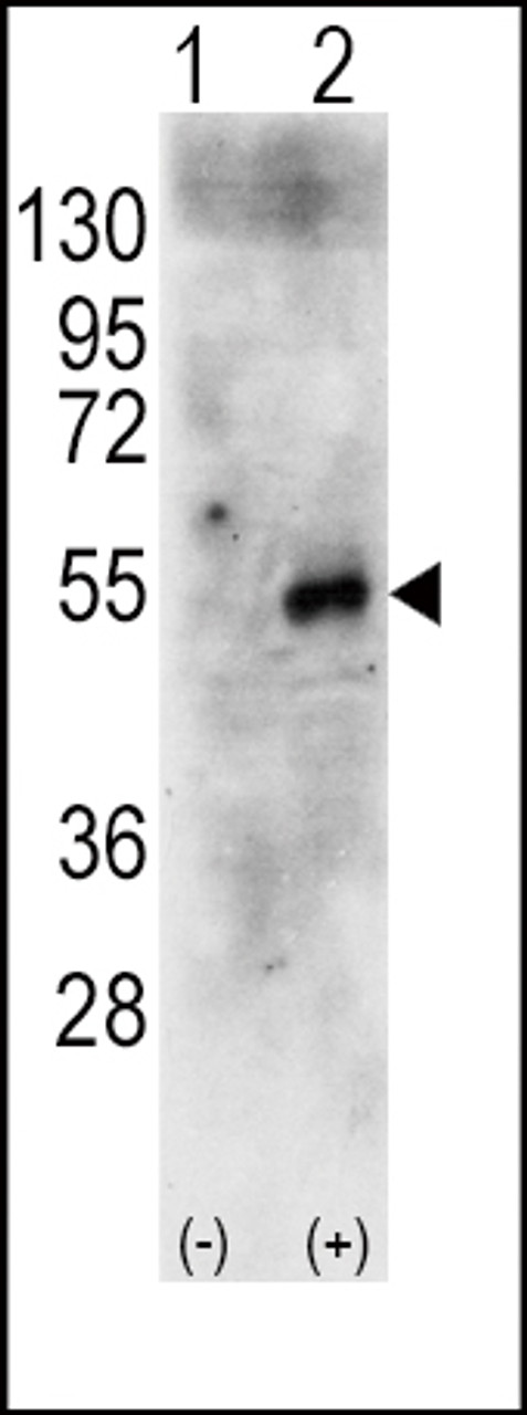 Western blot analysis of RPS6KB2 using rabbit polyclonal RPS6KB2 Antibody using 293 cell lysates (2 ug/lane) either nontransfected (Lane 1) or transiently transfected with the human RPS6KB2 gene (Lane 2) .
