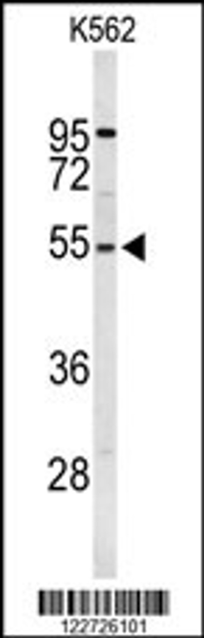 Western blot analysis of RPS6KB2 Antibody in K562 cell line lysates (35ug/lane)