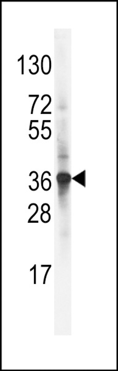 Western blot analysis of LDLRAP1 Antibody in NCI-H460 cell line lysates (35ug/lane)