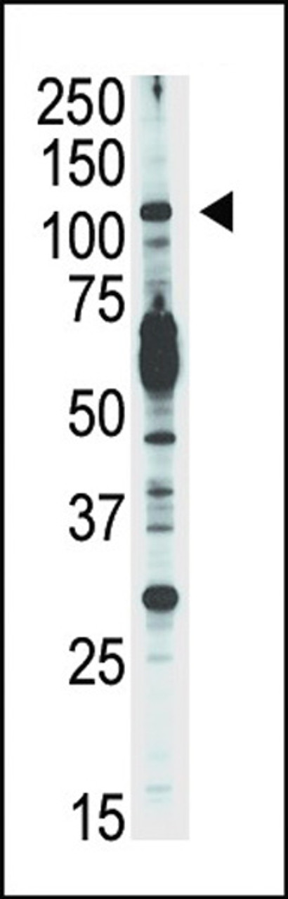 Western blot analysis of anti-PI3KCD Pab in Jurkat cell lysate