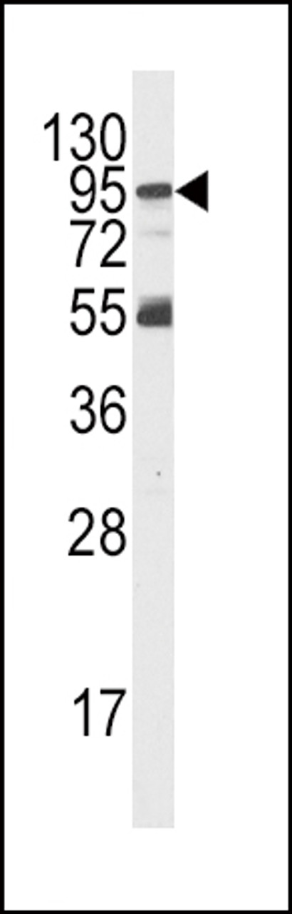 Western blot analysis of PI3KR5 Antibody Pab in K562 cell line lysates (35ug/lane) . PI3KR5 was detected using the purified polyclonal antibody.