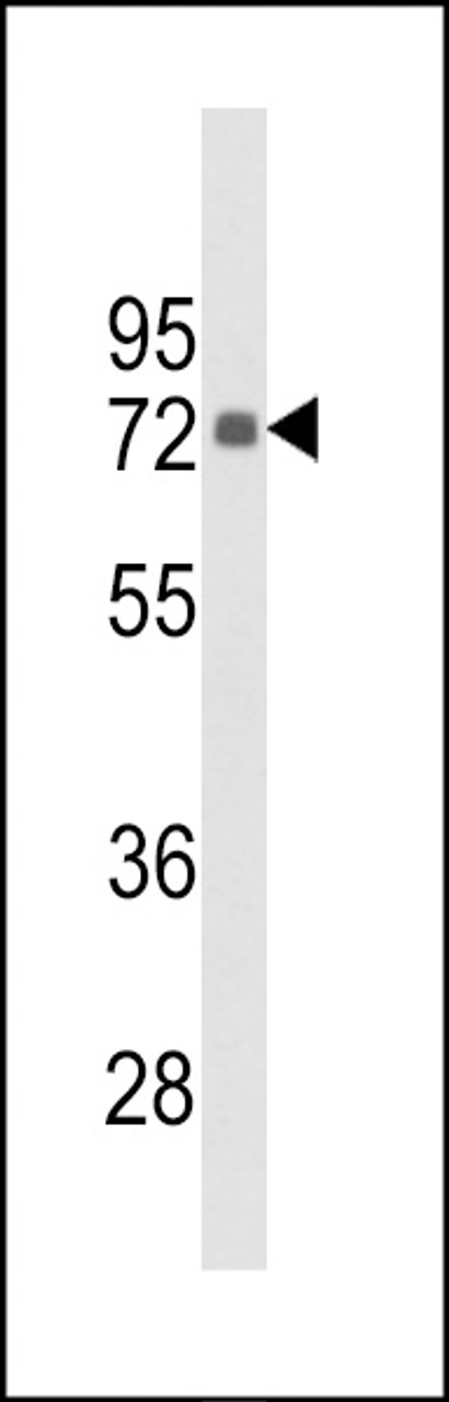 Western blot analysis of hPIP5K1G-L652 in Hela cell line lysates (35ug/lane)