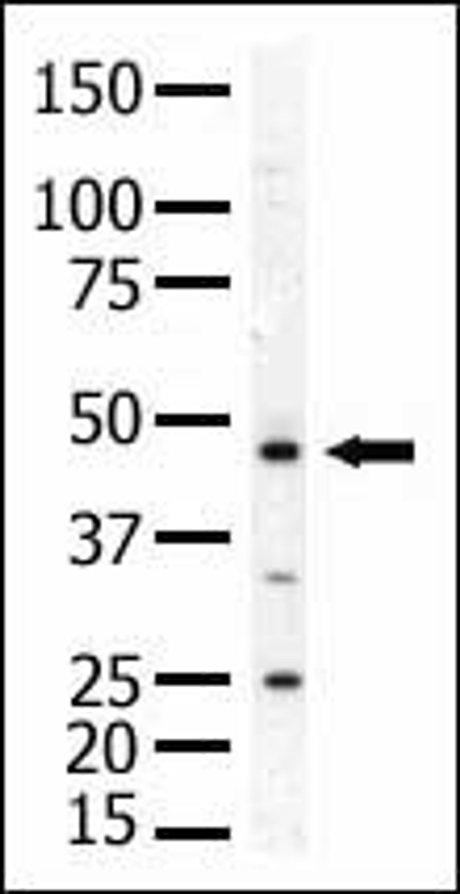 Antibody is used in Western blot to detect PIP5K2A in mouse skeletal muscle tissue lysate.