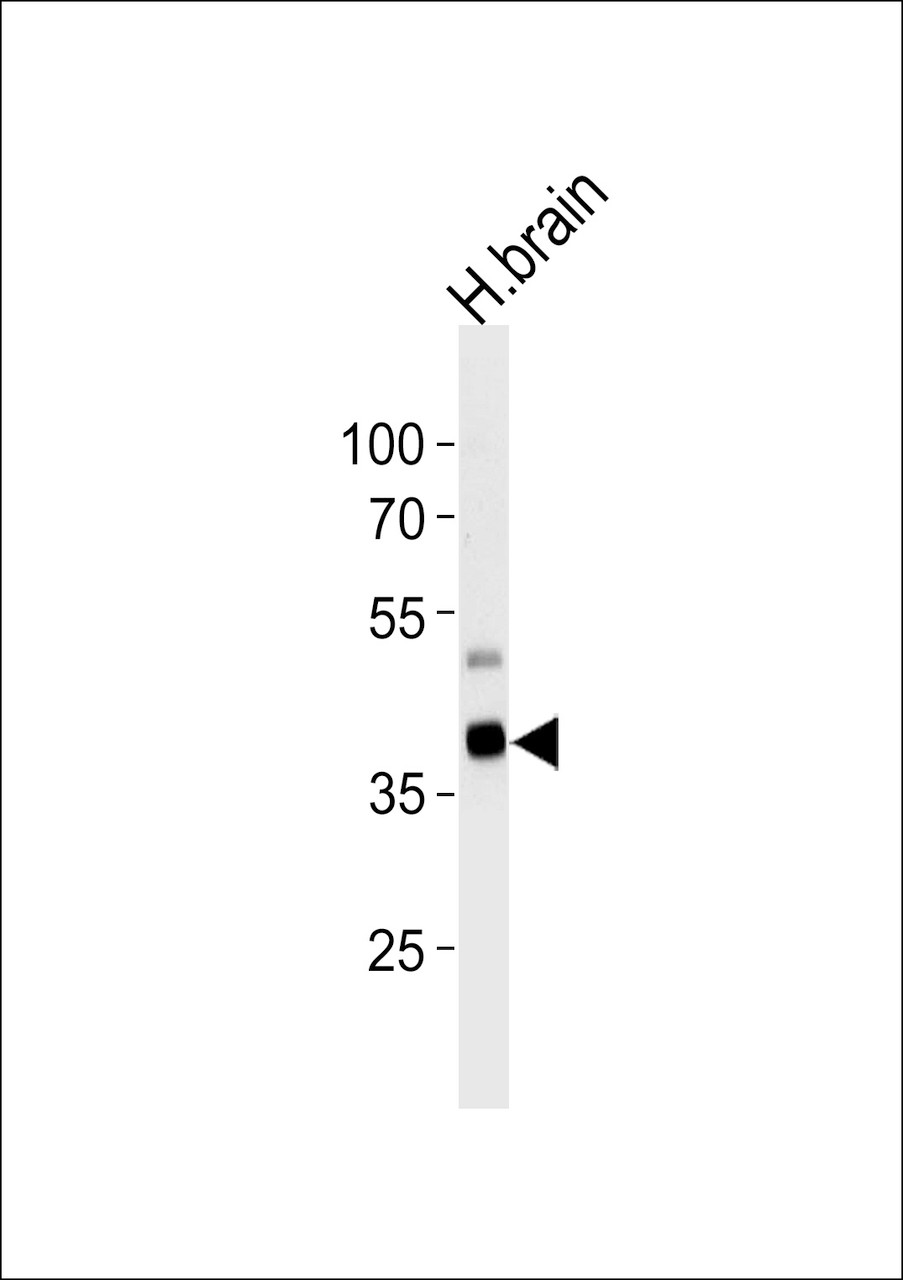Western blot analysis of lysate from human brain tissue lysate, using PIP5K2G Antibody (E348) at 1:1000 at each lane.