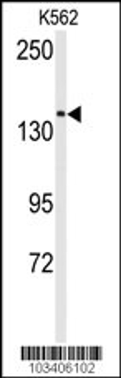 Antibody is used in Western blot to detect CHAK1 in K562 cell lysate.