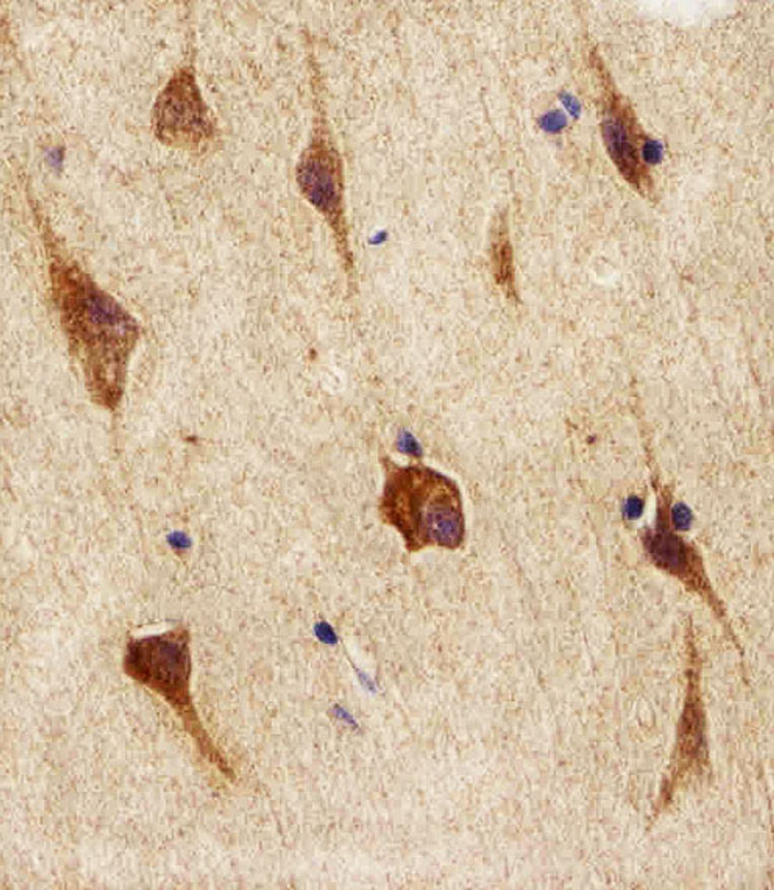 Immunohistochemical analysis of paraffin-embedded H. brain section using NEK2 Antibody. Antibody was diluted at 1:100 dilution. A peroxidase-conjugated goat anti-rabbit IgG at 1:400 dilution was used as the secondary antibody, followed by DAB staining.
