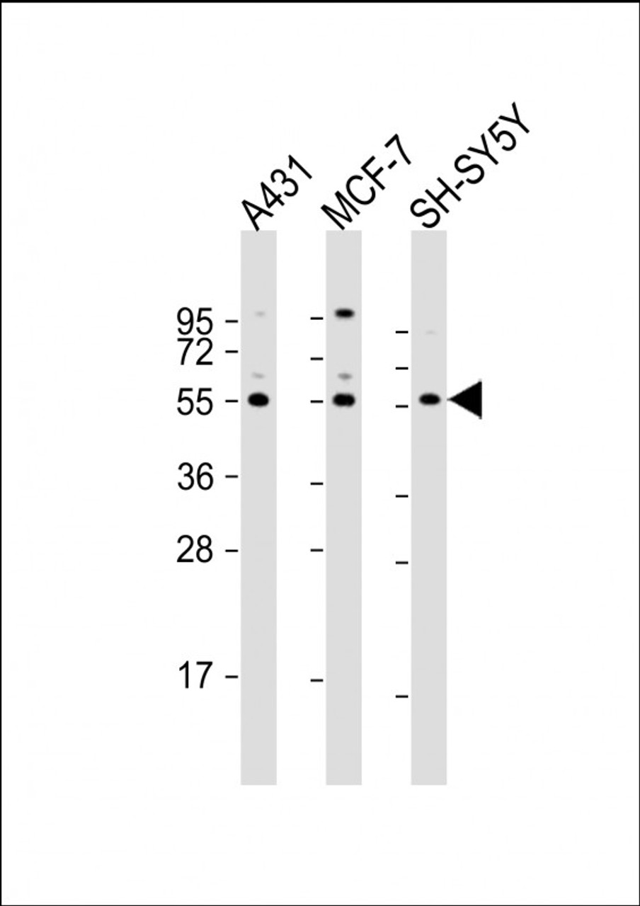 Western Blot at 1:2000 dilution Lane 1: A431 whole cell lysate Lane 2: MCF-7 whole cell lysate Lane 3: SH-SY5Y whole cell lysate Lysates/proteins at 20 ug per lane.