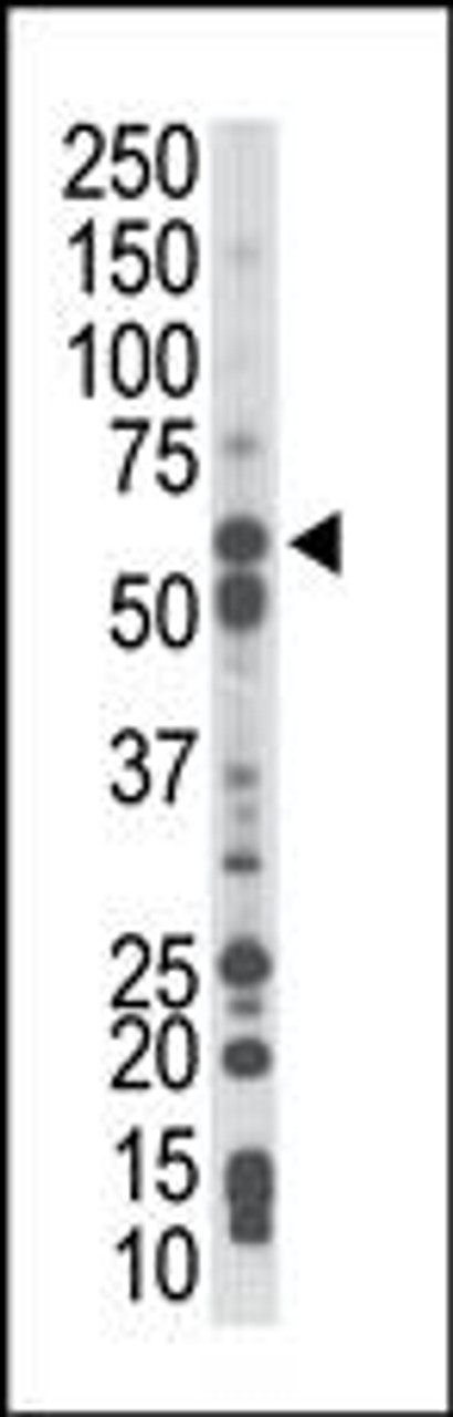 Antibody is used in Western blot to detect PCK1 in mouse liver tissue lysate.