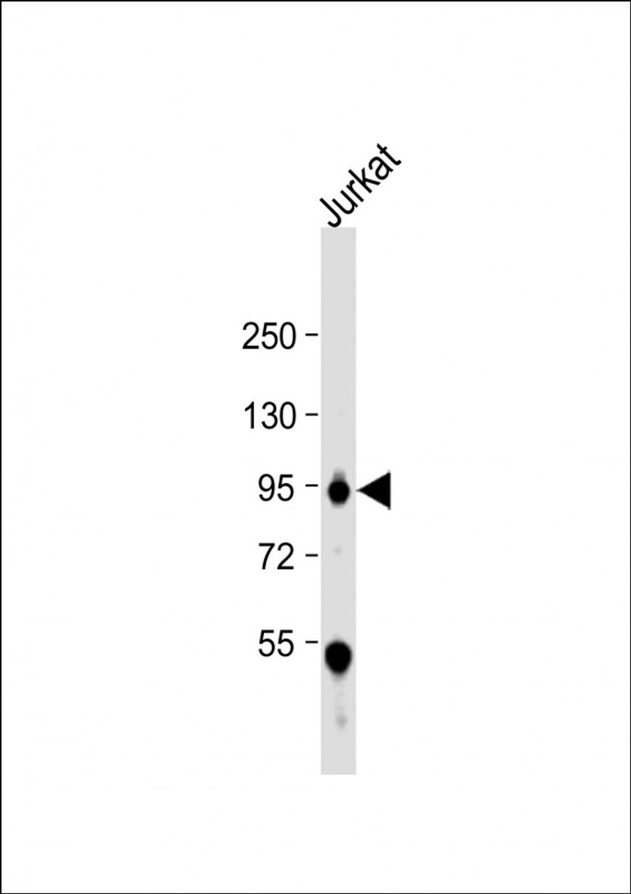 Western Blot at 1:1000 dilution + Jurkat whole cell lysate Lysates/proteins at 20 ug per lane.