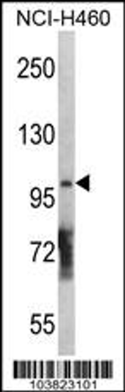 Western blot analysis in NCI-H460 cell line lysates (35ug/lane) .This demonstrates the DGKQ antibody detected the DGKQ protein (arrow) .