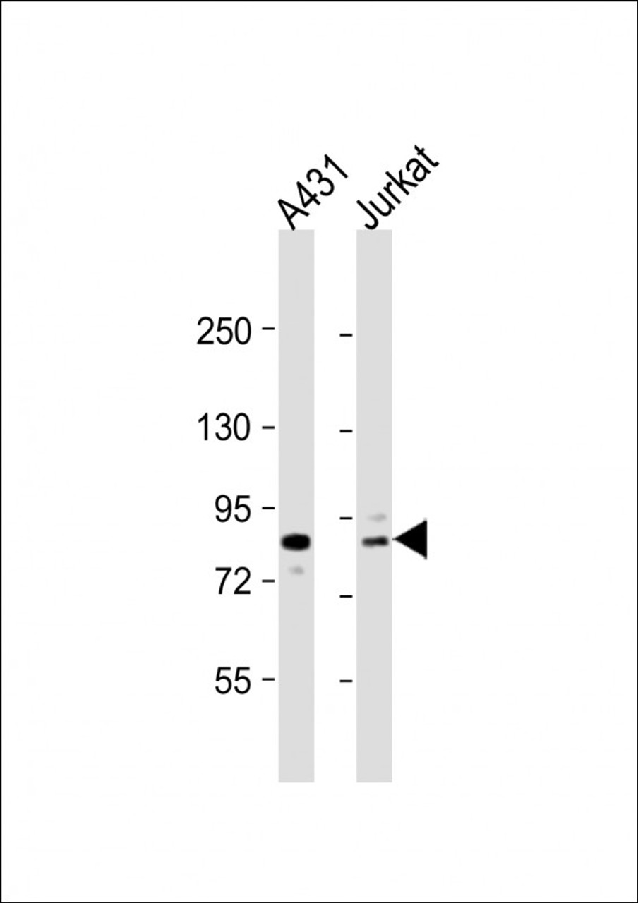 Western Blot at 1:1000 dilution Lane 1: A431 whole cell lysate Lane 2: Jurkat whole cell lysate Lysates/proteins at 20 ug per lane.